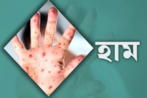 সিলেট হামে আরও এক শিশুর মৃত্যু