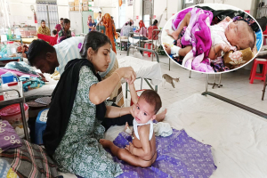 সিলেটে চোখ রাঙ্গাচ্ছে হাম : শিশুদের সাথে আক্রান্ত হচ্ছেন বয়স্করাও